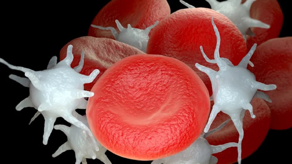 嚴重血小板增多症 (ET) 1 嚴重血小板增多症 (ET)