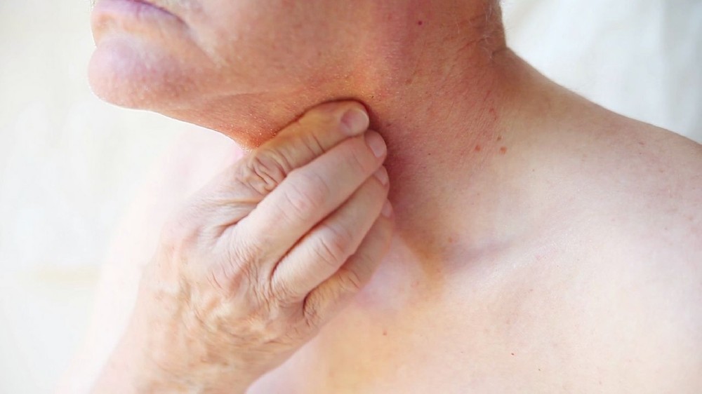 下咽癌(下咽癌) 1 下咽癌 (Hypopharyngeal Carcinoma)