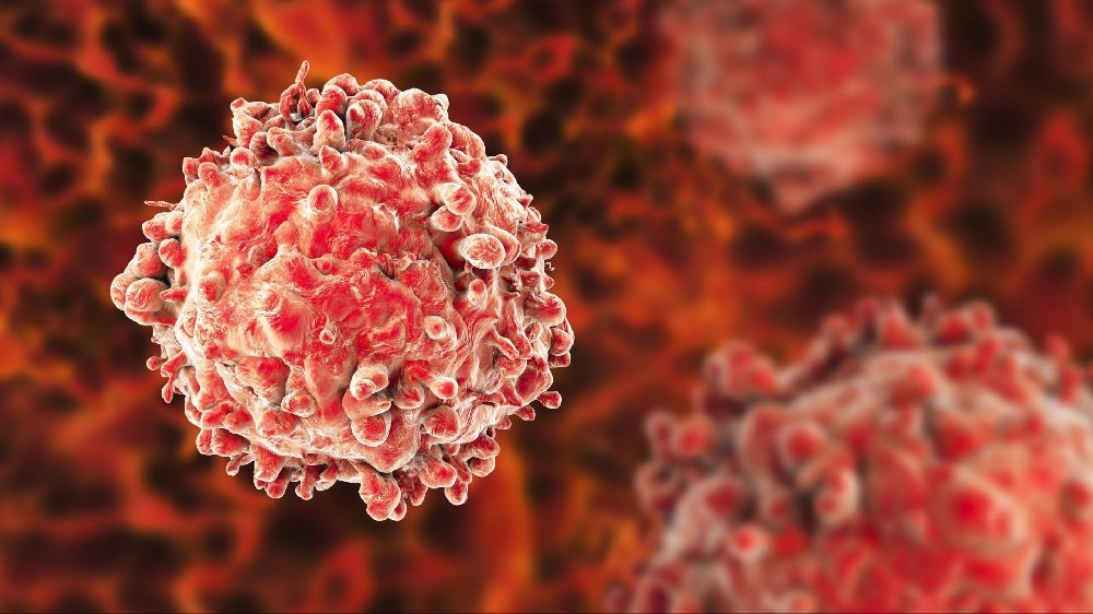 白血病 1 白血病