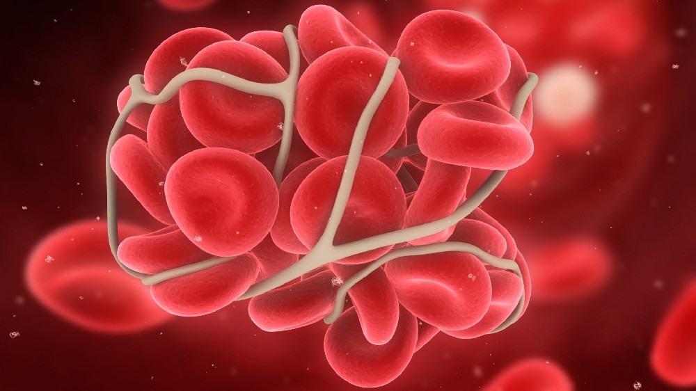 骨髓增生性腫瘤 (MPN) 1 骨髓增生性腫瘤 MPNs